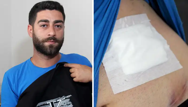 Karnındaki Ağrı, Gizli Bir Tehlikenin İşaretiyi? Röntgen Sonuçları Şok Etti!