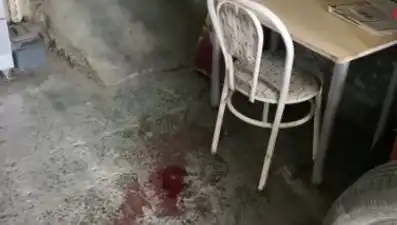 Sandalyeden Düşerek Ağır Yaralanan Adamın Yaşadığı Korku Dolu Anlar