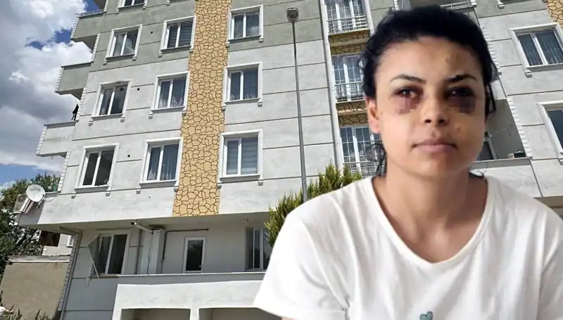 Düğün Nişanı Değil, Maganda Faciası: Gözüne Saçma Isabet Eden Bekar Genç